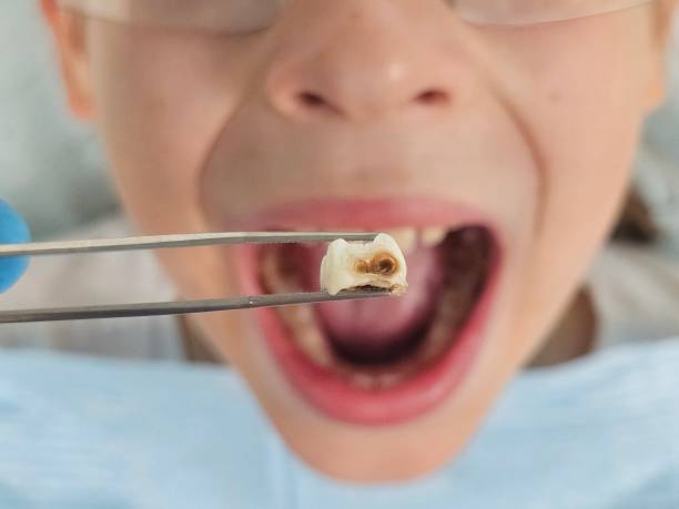 Best Tooth Infection Emergency Dentist  in Eveleth, MN